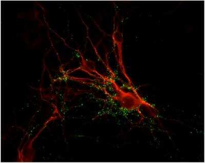 Immunocytochemistry/ Immunofluorescence: Synapsin I Antibody [NB300-104]