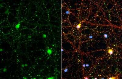 Immunocytochemistry/ Immunofluorescence: Synapsin II Antibody (GT1446) [NBP3-13694]