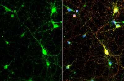 Immunocytochemistry/ Immunofluorescence: Synapsin II Antibody (GT387) [NBP3-13689]