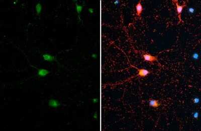 Immunocytochemistry/ Immunofluorescence: Synapsin II Antibody (GT965) [NBP3-13690]