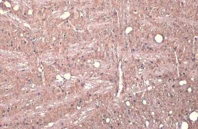 Immunohistochemistry-Paraffin: Synapsin II Antibody [NBP3-13445]