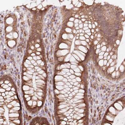 Immunohistochemistry-Paraffin: Synaptic glycoprotein SC2 Antibody [NBP2-49230]