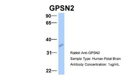 Western Blot: Synaptic glycoprotein SC2 Antibody [NBP1-60088]
