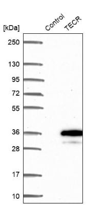 Western Blot: Synaptic glycoprotein SC2 Antibody [NBP2-49230]