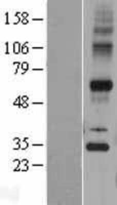 Western Blot: Synaptic glycoprotein SC2 Overexpression Lysate [NBP2-04416]