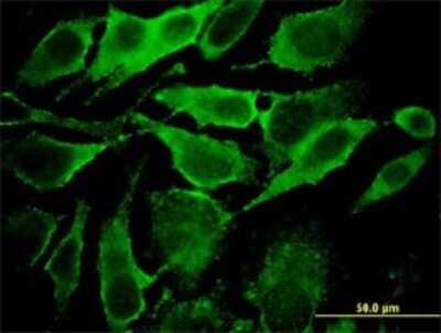 Immunocytochemistry/ Immunofluorescence: Synaptobrevin homolog YKT6 Antibody (1F8) [H00010652-M03]