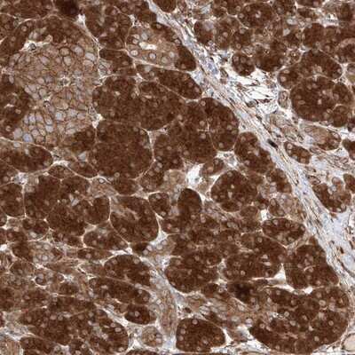 Immunohistochemistry-Paraffin: Synaptobrevin homolog YKT6 Antibody [NBP1-87439]