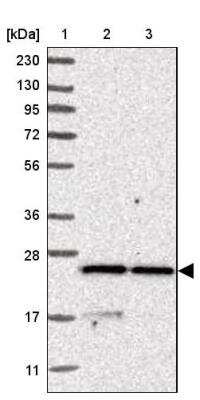 Western Blot: Synaptobrevin homolog YKT6 Antibody [NBP1-87439]