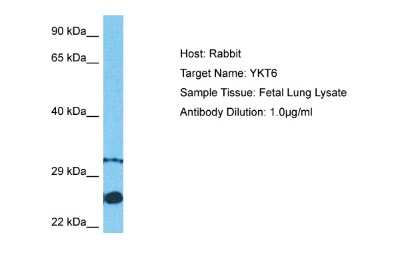 Western Blot: Synaptobrevin homolog YKT6 Antibody [NBP2-85855]