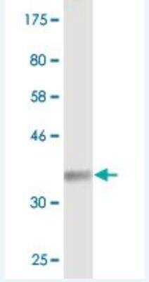 Western Blot: Synaptogyrin 2 Antibody (1G7) [H00009144-M03]
