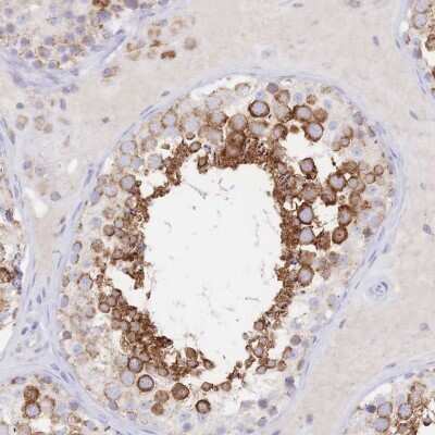 Immunohistochemistry: Synaptogyrin 4 Antibody [NBP2-34124]