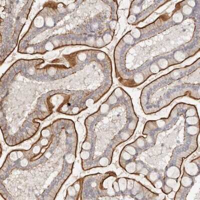 Immunohistochemistry-Paraffin: Synaptogyrin 4 Antibody [NBP1-87530]