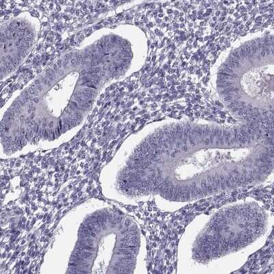 Immunohistochemistry-Paraffin: Synaptogyrin 4 Antibody [NBP1-87530]
