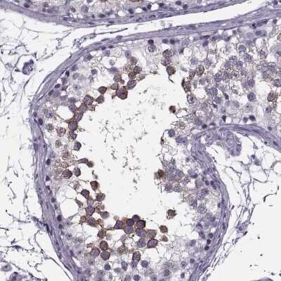 Immunohistochemistry-Paraffin: Synaptogyrin 4 Antibody [NBP1-87530]