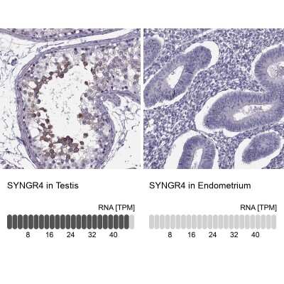 Immunohistochemistry-Paraffin: Synaptogyrin 4 Antibody [NBP1-87530]