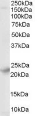 Western Blot: Synaptogyrin 4 Antibody [NB300-984]