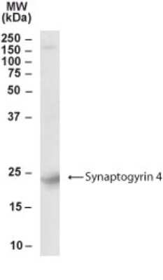 Western Blot: Synaptogyrin 4 Antibody [NB300-984]