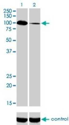 Western Blot: Synaptojanin 2 Antibody (2H8) [H00008871-M02]