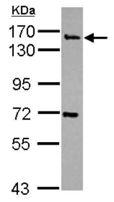 Western Blot: Synaptojanin 2 Antibody [NBP2-20543]