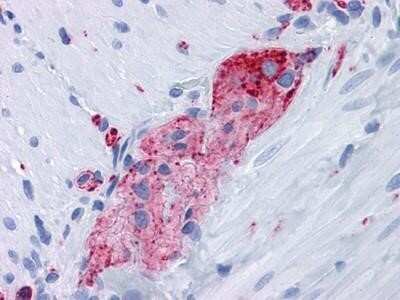 Immunohistochemistry: Synaptophysin Antibody (7H12) - Azide and BSA Free [NBP2-80972]