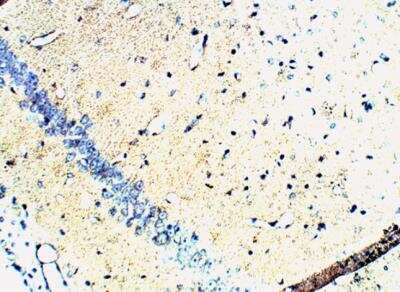 Immunohistochemistry-Paraffin: Synaptophysin Antibody [NB300-653]