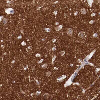 Immunohistochemistry-Paraffin: Synaptophysin Antibody [NBP1-88112]