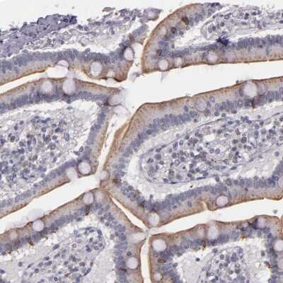 Immunohistochemistry-Paraffin: Synaptophysin Antibody [NBP1-88112]