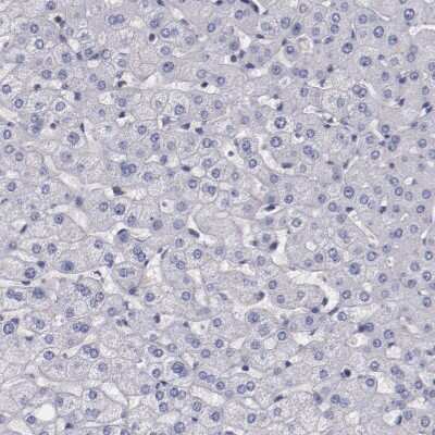 Immunohistochemistry-Paraffin: Synaptophysin Antibody [NBP1-88112]