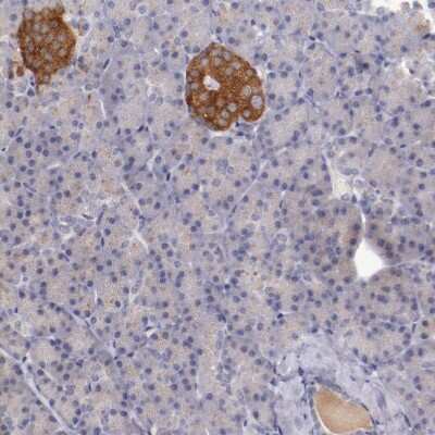 Immunohistochemistry-Paraffin: Synaptophysin Antibody [NBP1-88112]
