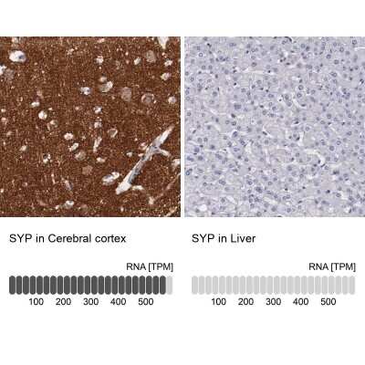 Immunohistochemistry-Paraffin: Synaptophysin Antibody [NBP1-88112]