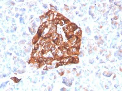 Immunohistochemistry-Paraffin: Synaptophysin Antibody (SYP/4503R) [NBP3-07325]