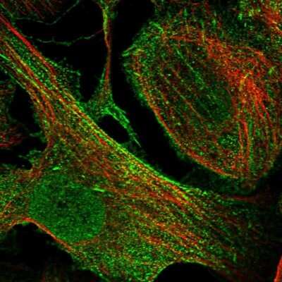 Immunocytochemistry/ Immunofluorescence: Synaptopodin Antibody [NBP1-87887]