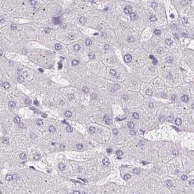 Immunohistochemistry-Paraffin: Synaptoporin Antibody [NBP2-13405]