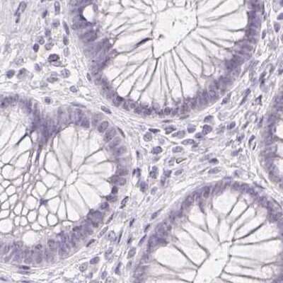 Immunohistochemistry-Paraffin: Synaptoporin Antibody [NBP2-13405]