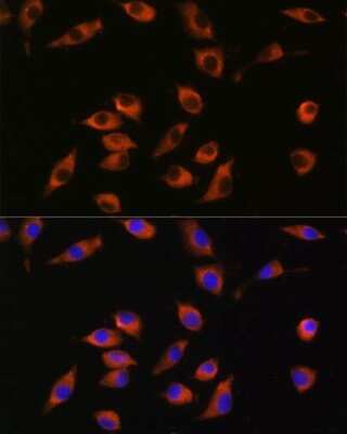 Immunocytochemistry/ Immunofluorescence: Synaptotagmin 12 Antibody - Azide and BSA Free [NBP3-15537]