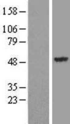 Western Blot: Synaptotagmin 13 Overexpression Lysate [NBL1-16649]