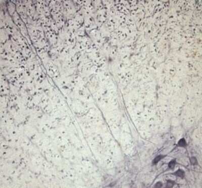 Immunohistochemistry: Synaptotagmin 2 Antibody [NB100-91297]