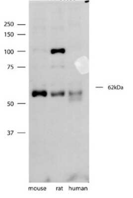 Western Blot: Synaptotagmin 3 Antibody [NBP1-59689]
