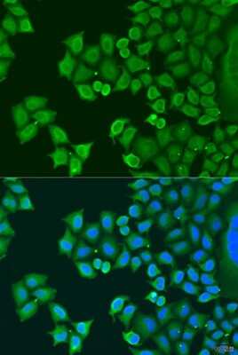 Immunocytochemistry/ Immunofluorescence: Synaptotagmin 4 Antibody - BSA Free [NBP2-93411]