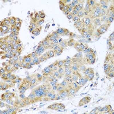 Immunohistochemistry-Paraffin: Synaptotagmin 4 Antibody - BSA Free [NBP2-93411]