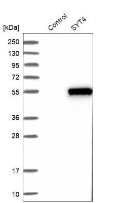 Western Blot: Synaptotagmin 4 Antibody [NBP2-13408]