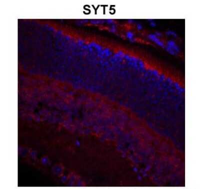 Immunohistochemistry-Paraffin: Synaptotagmin 5 Antibody [NBP1-69104]