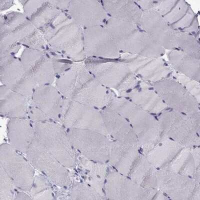 Immunohistochemistry-Paraffin: Synaptotagmin 5 Antibody [NBP2-62725]