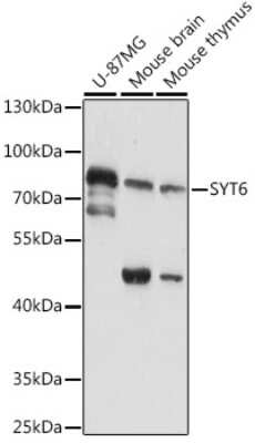 Western Blot: Synaptotagmin 6 AntibodyAzide and BSA Free [NBP2-93940]
