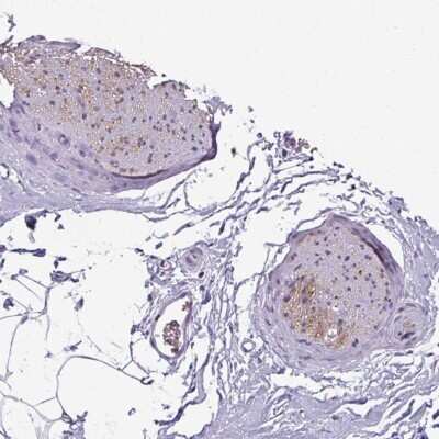 Immunohistochemistry-Paraffin: Synaptotagmin 8 Antibody [NBP2-30750]