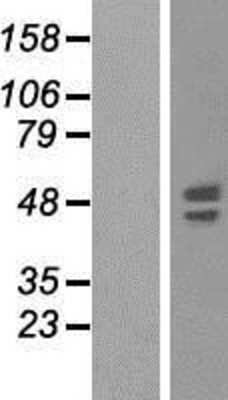 Western Blot: Synaptotagmin 6 Overexpression Lysate [NBP2-04529]