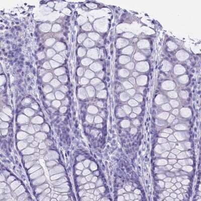 Immunohistochemistry-Paraffin: Syncollin Antibody [NBP2-13402]