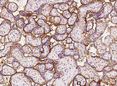 Immunohistochemistry-Paraffin: Syndecan-1/CD138 Antibody (160) [NBP2-89900]
