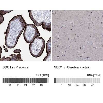 Immunohistochemistry-Paraffin: Syndecan-1/CD138 Antibody [NBP3-16984]