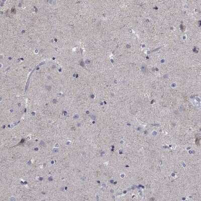 Immunohistochemistry-Paraffin: Syndecan-1/CD138 Antibody [NBP3-16984]